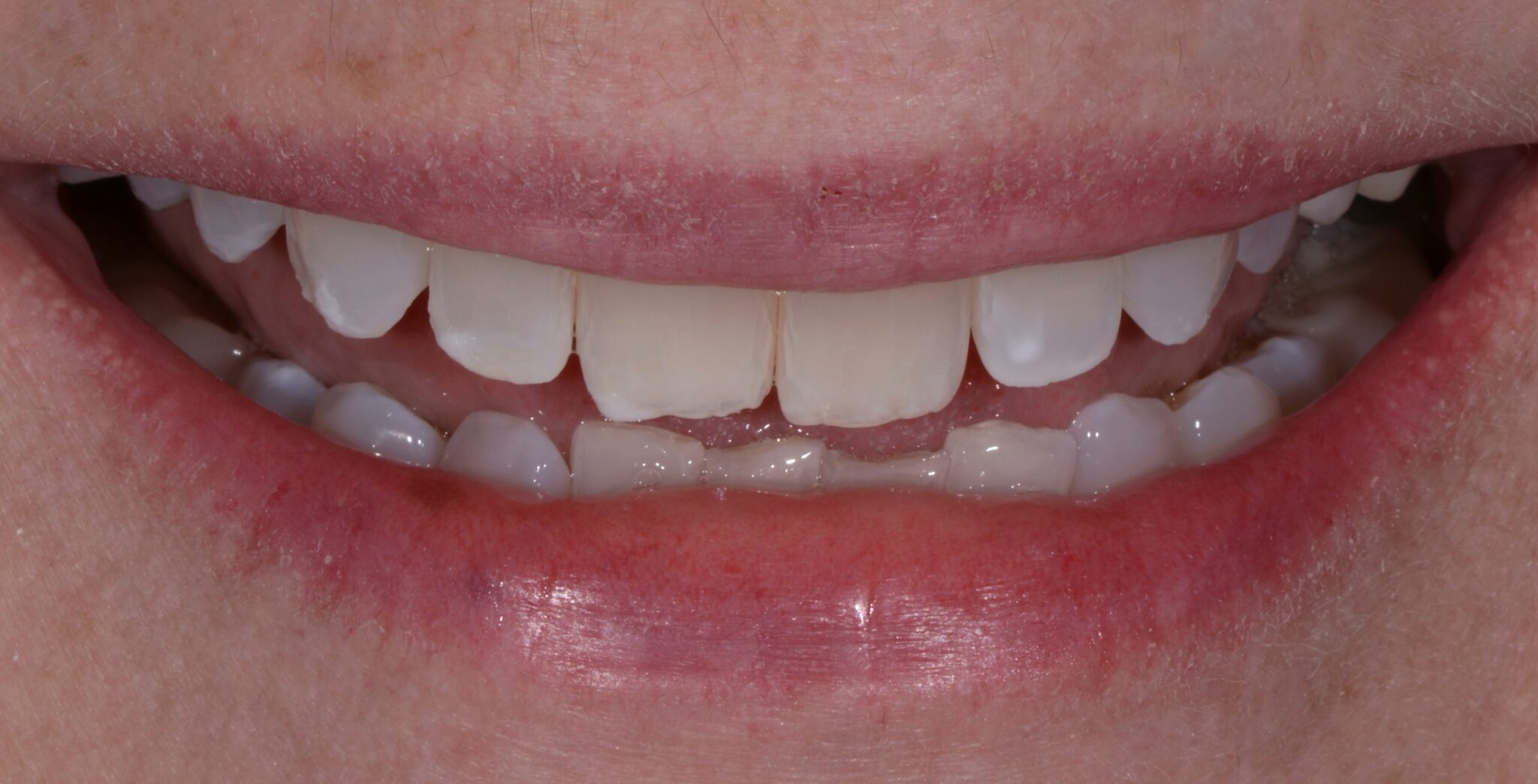 Elim Dental dentist in Mount Kisco, NY DR. JIN SUB OH, DMD, MS Schema yoast