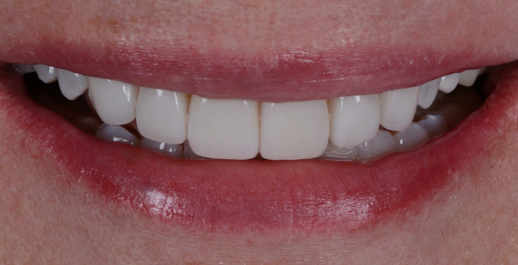 Elim Dental dentist in Mount Kisco, NY DR. JIN SUB OH, DMD, MS Schema yoast