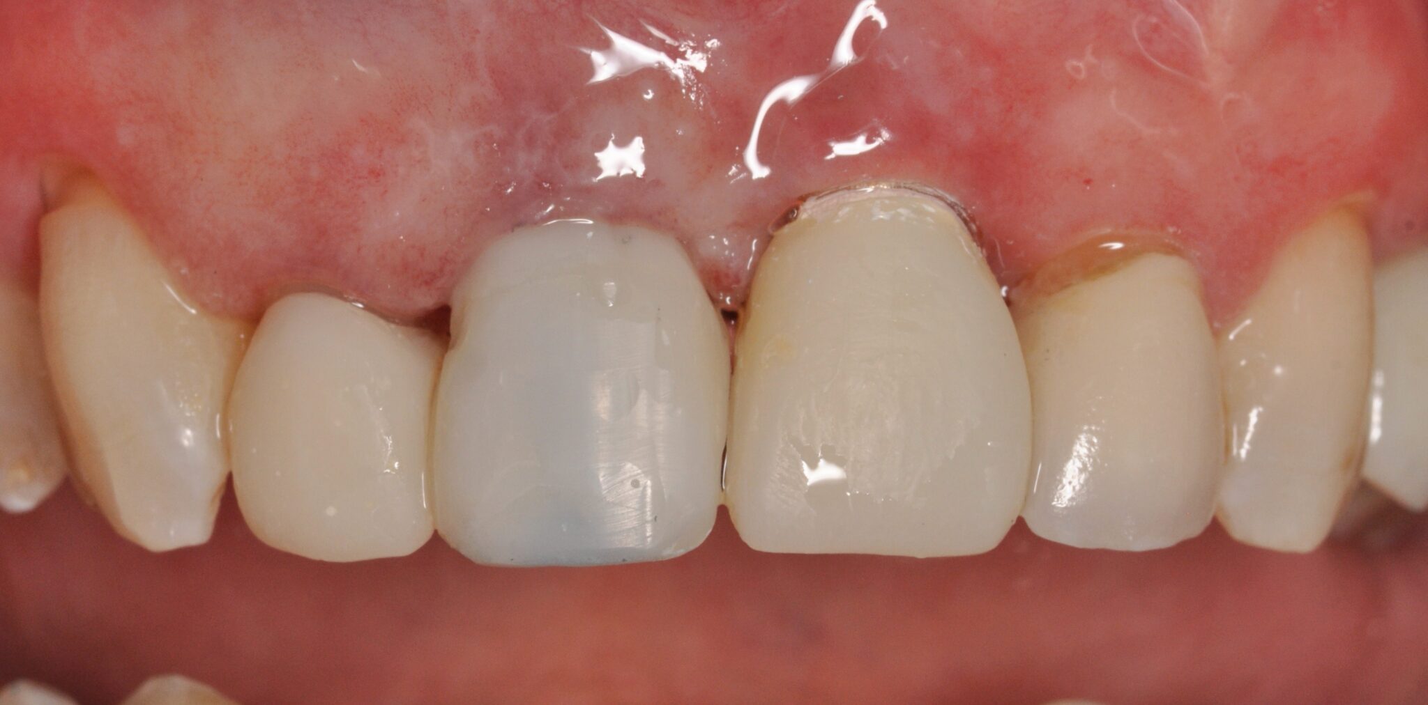 Elim Dental dentist in Mount Kisco, NY DR. JIN SUB OH, DMD, MS Schema yoast