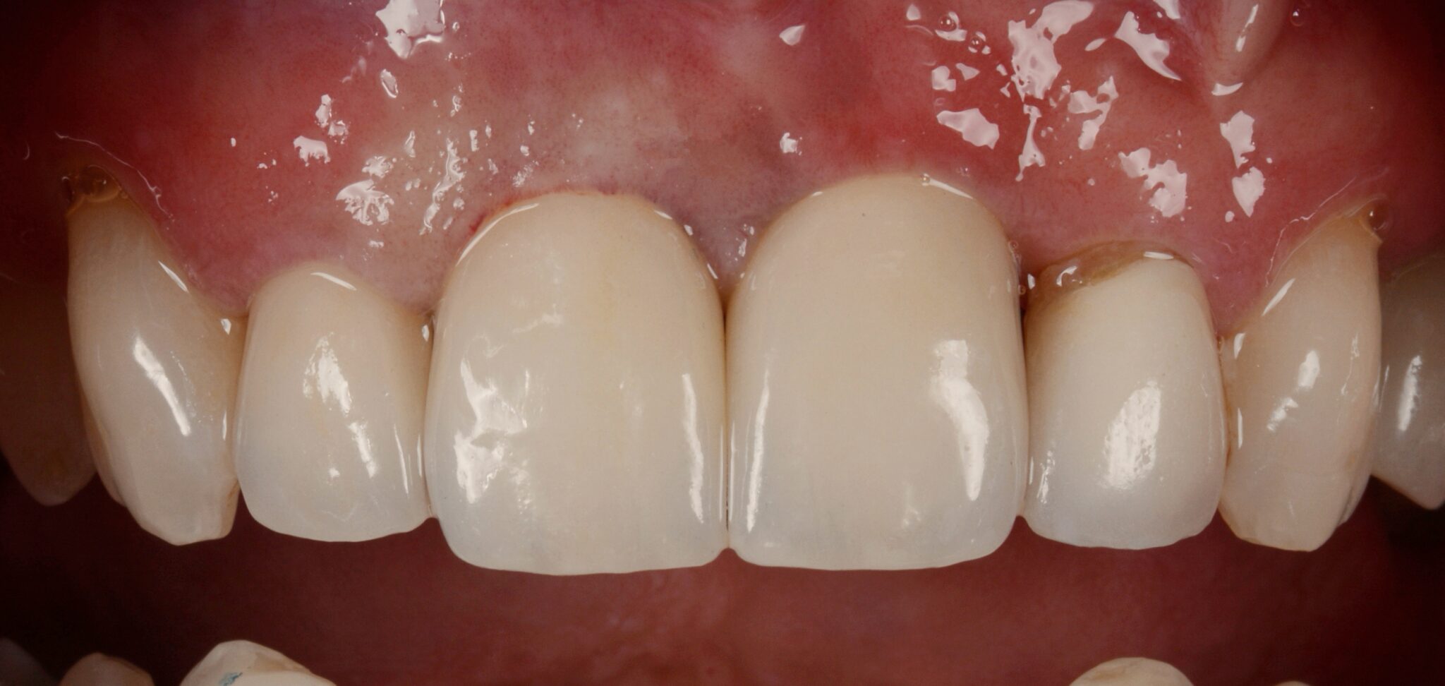 Elim Dental dentist in Mount Kisco, NY DR. JIN SUB OH, DMD, MS Schema yoast