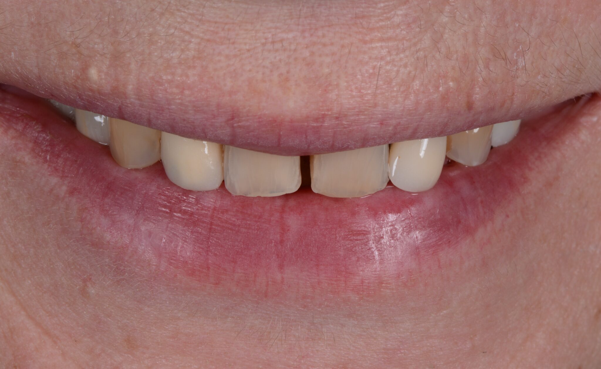 Elim Dental dentist in Mount Kisco, NY DR. JIN SUB OH, DMD, MS Schema yoast