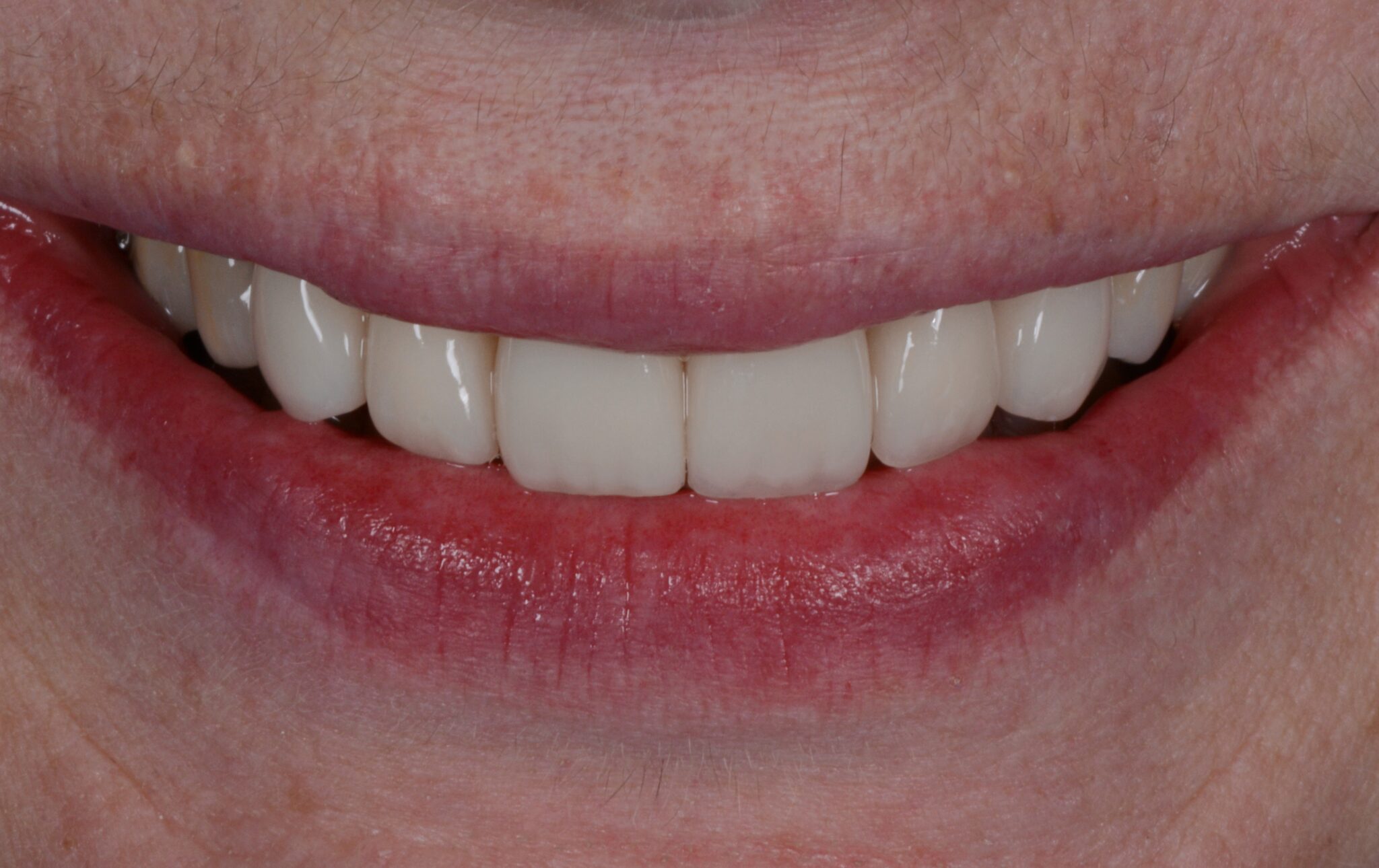 Elim Dental dentist in Mount Kisco, NY DR. JIN SUB OH, DMD, MS Schema yoast