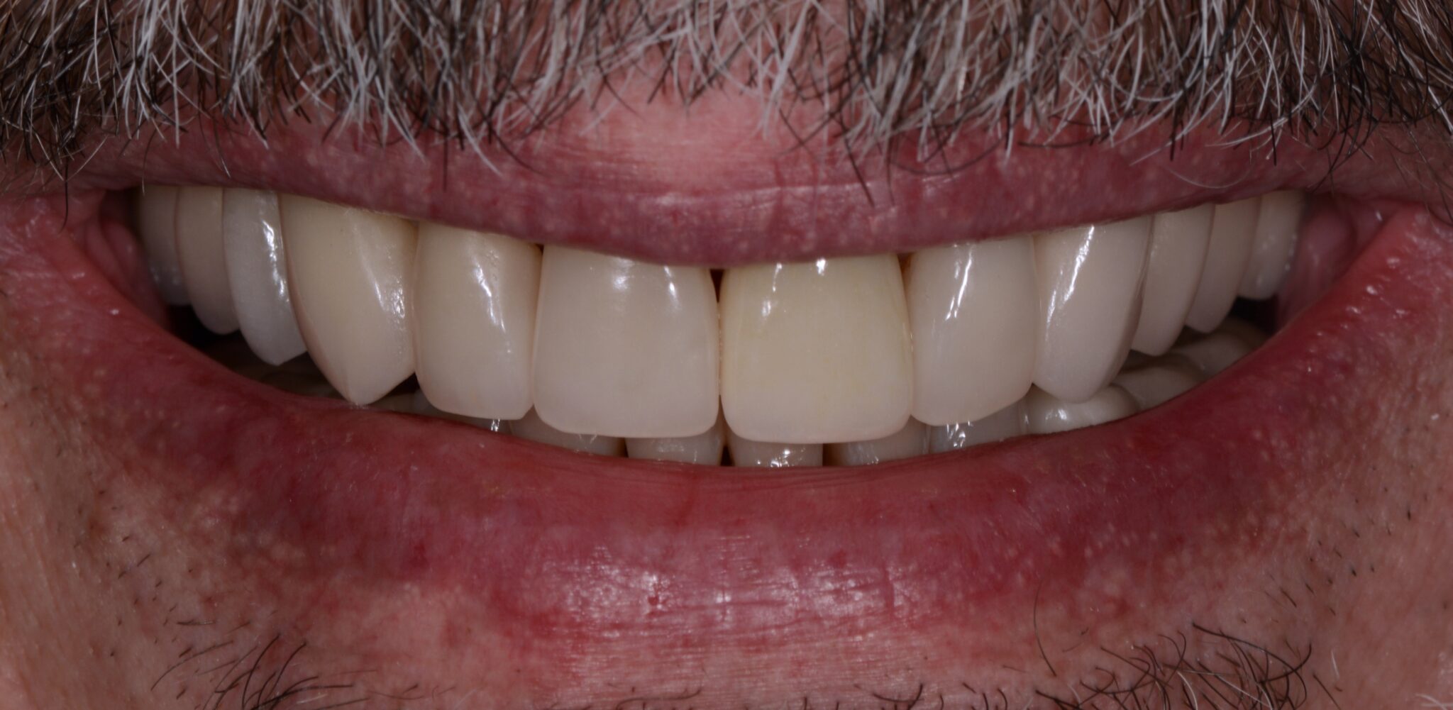 Elim Dental dentist in Mount Kisco, NY DR. JIN SUB OH, DMD, MS Schema yoast