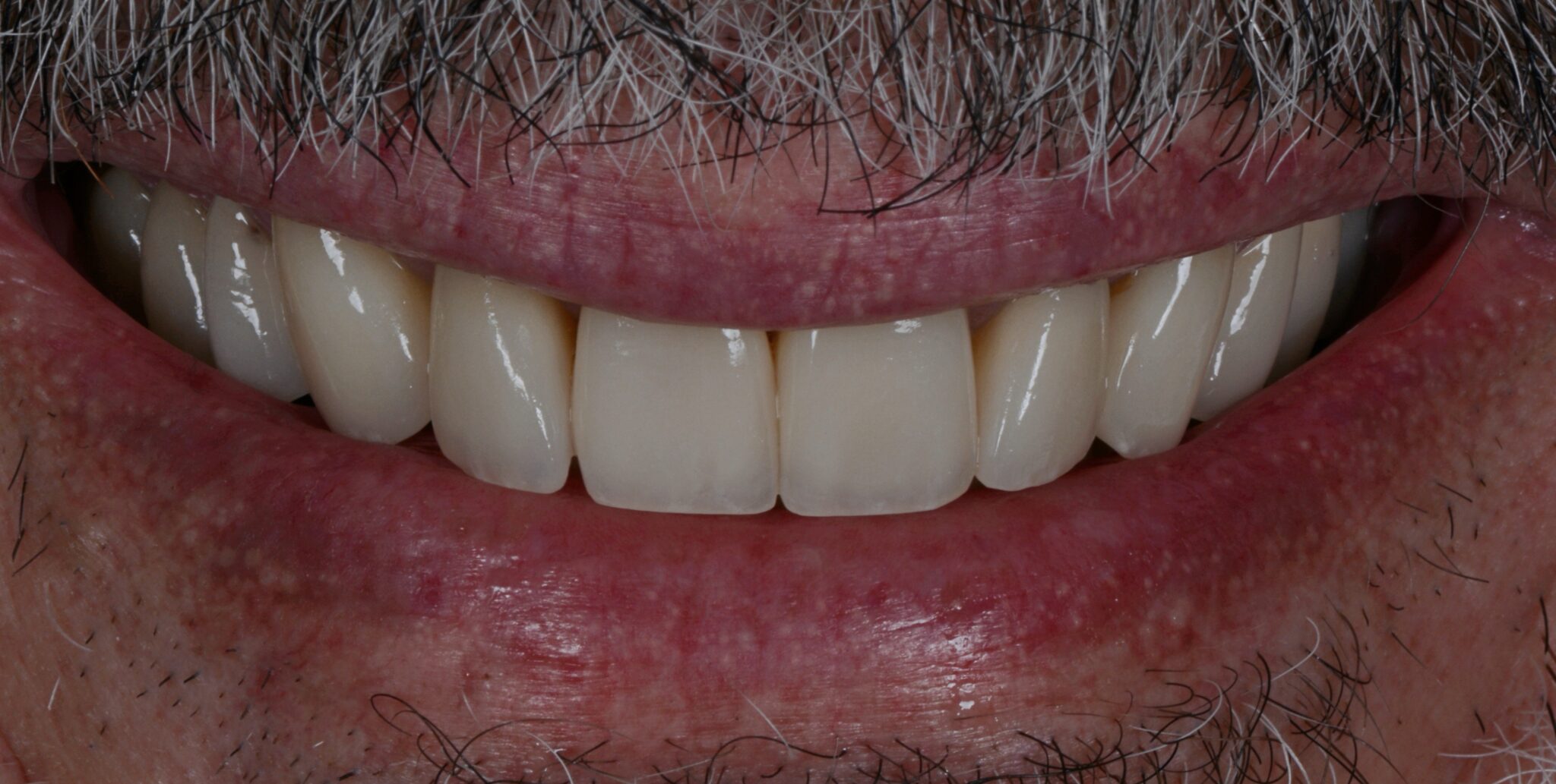 Elim Dental dentist in Mount Kisco, NY DR. JIN SUB OH, DMD, MS Schema yoast