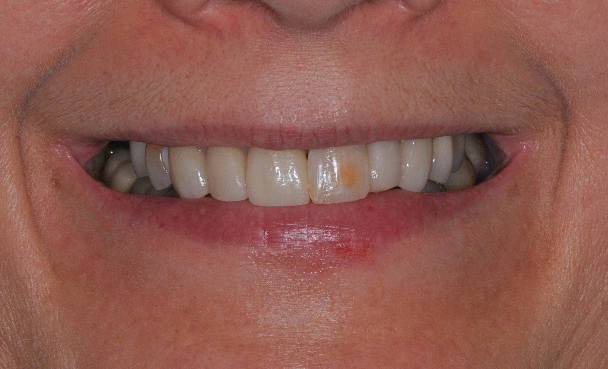Elim Dental dentist in Mount Kisco, NY DR. JIN SUB OH, DMD, MS Schema yoast