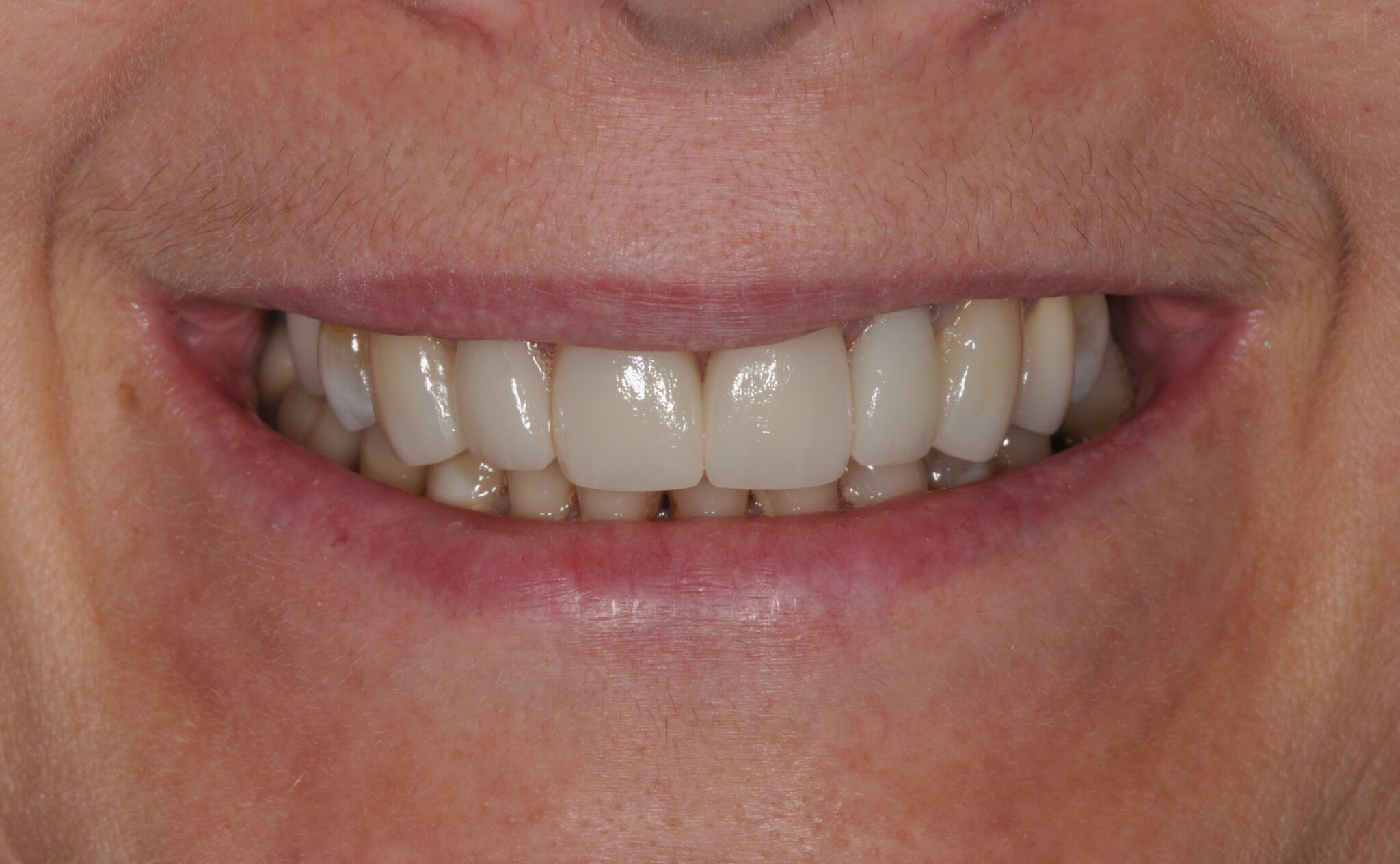 Elim Dental dentist in Mount Kisco, NY DR. JIN SUB OH, DMD, MS Schema yoast