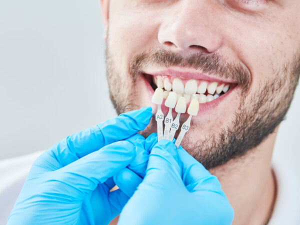 dental veneers Elim Dental dentist in Mt Kisco New York Dr. Jin Sub Oh dds