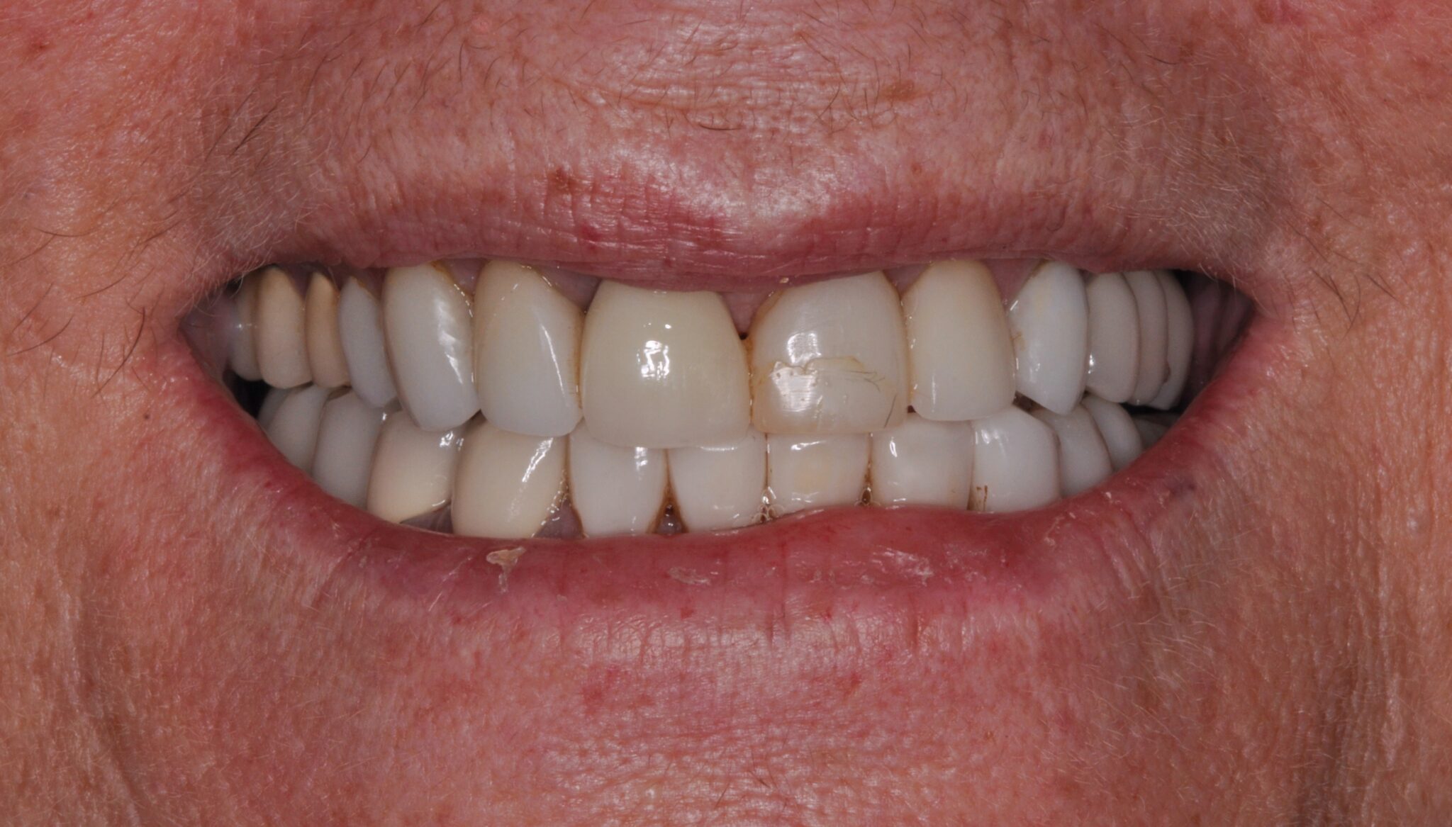 Elim Dental dentist in Mount Kisco, NY DR. JIN SUB OH, DMD, MS Schema yoast