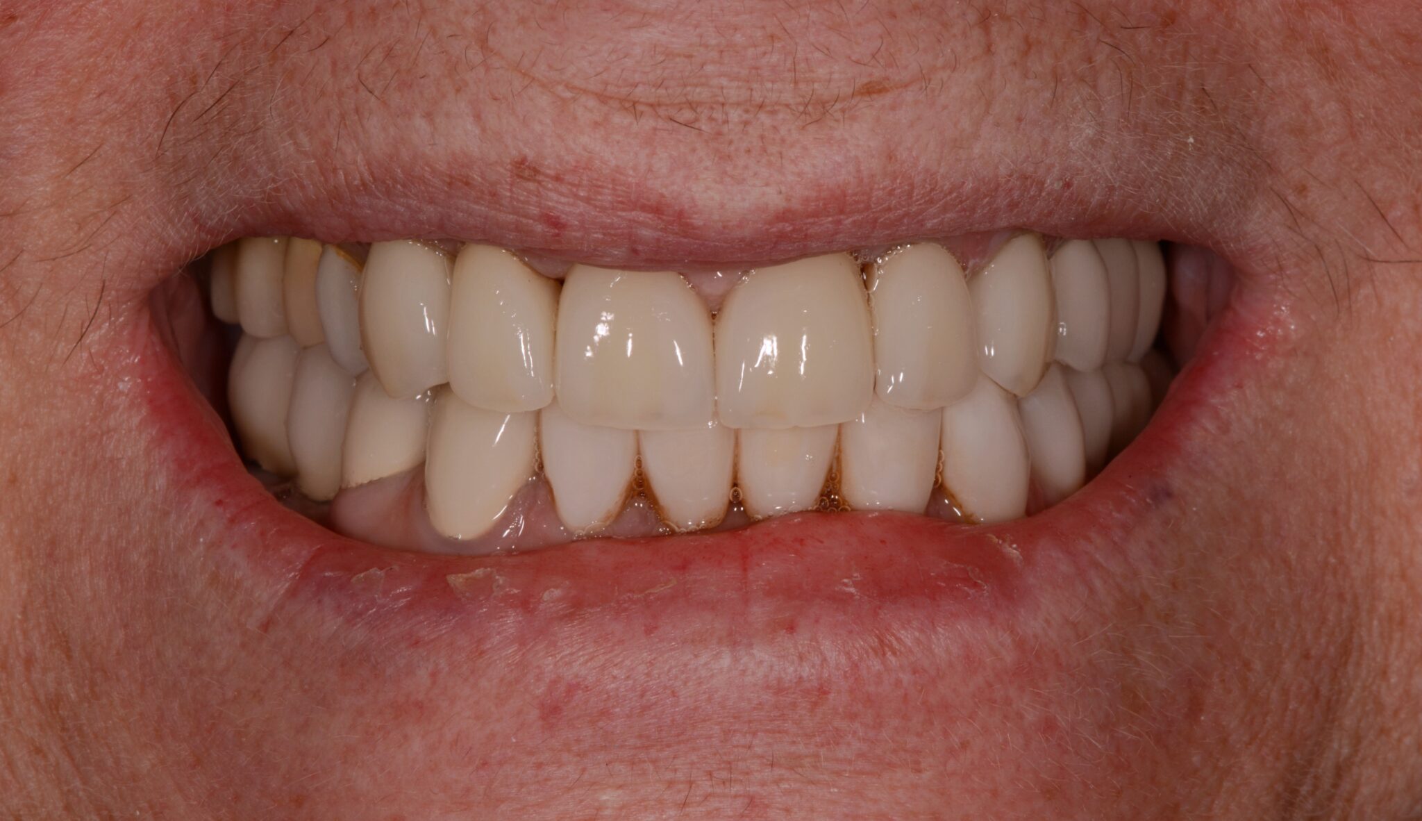 Elim Dental dentist in Mount Kisco, NY DR. JIN SUB OH, DMD, MS Schema yoast