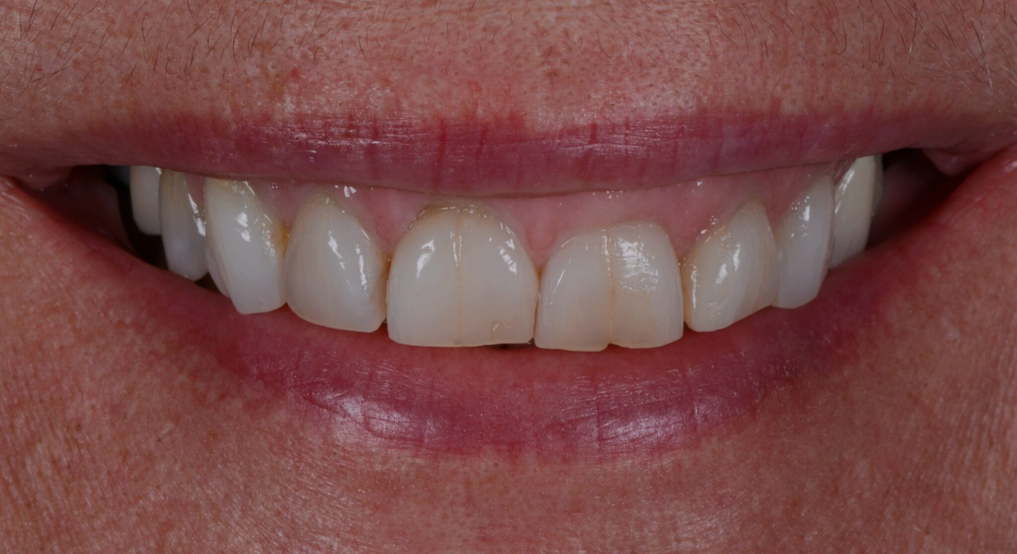 Elim Dental dentist in Mount Kisco, NY DR. JIN SUB OH, DMD, MS Schema yoast