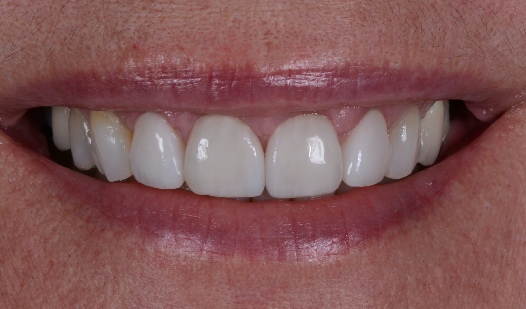 Elim Dental dentist in Mount Kisco, NY DR. JIN SUB OH, DMD, MS Schema yoast