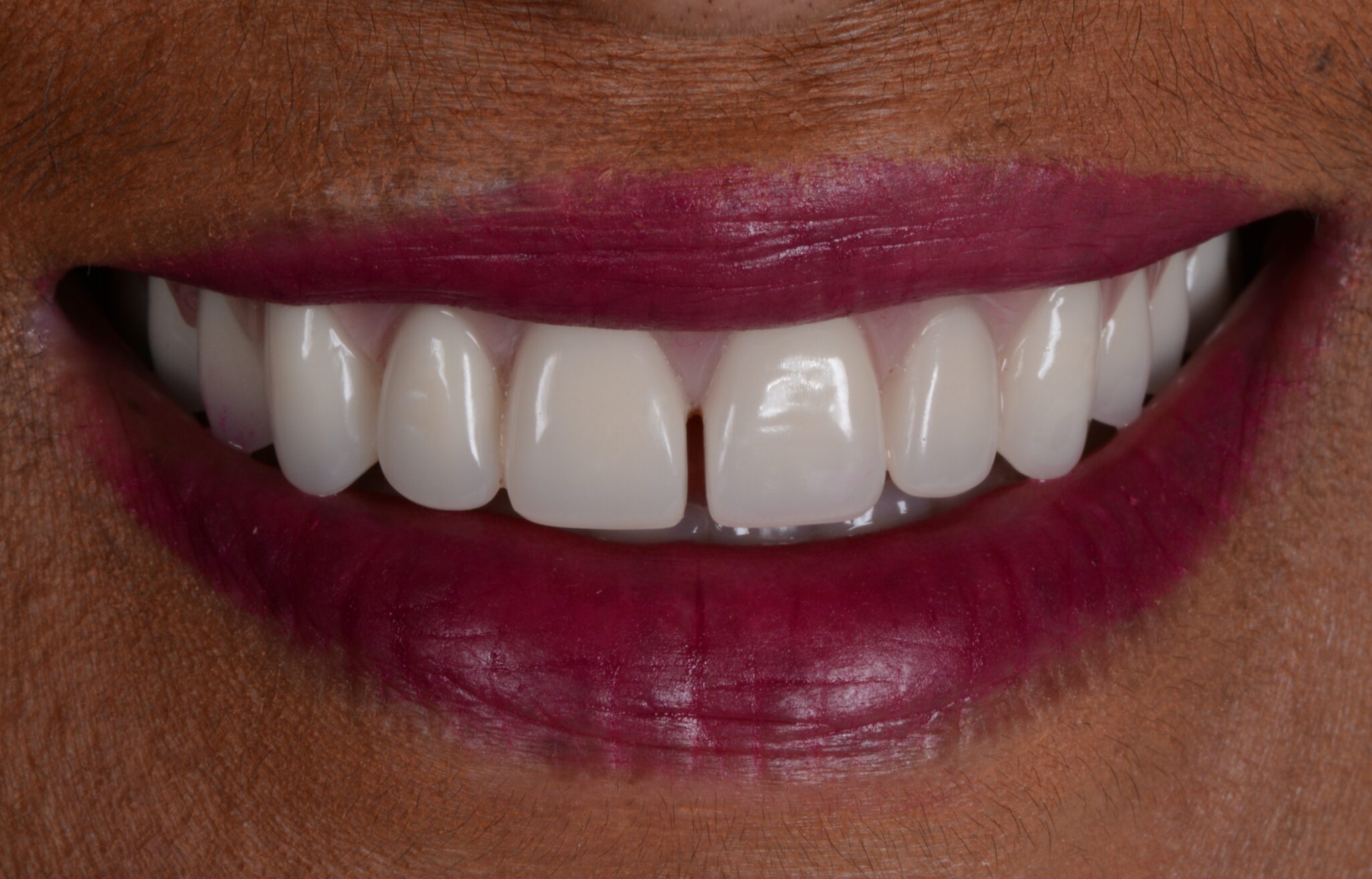 Elim Dental dentist in Mount Kisco, NY DR. JIN SUB OH, DMD, MS Schema yoast