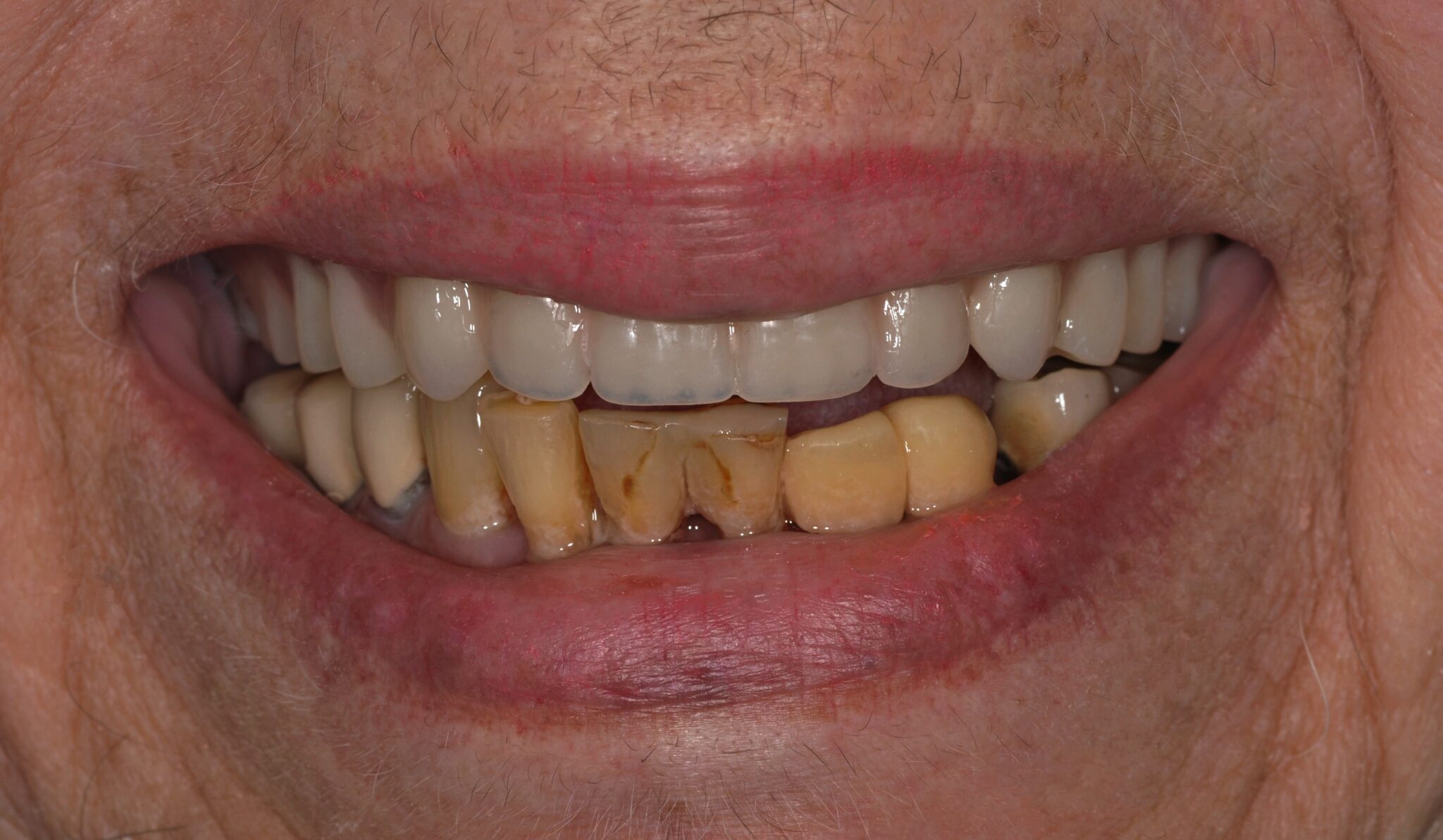 Elim Dental dentist in Mount Kisco, NY DR. JIN SUB OH, DMD, MS Schema yoast