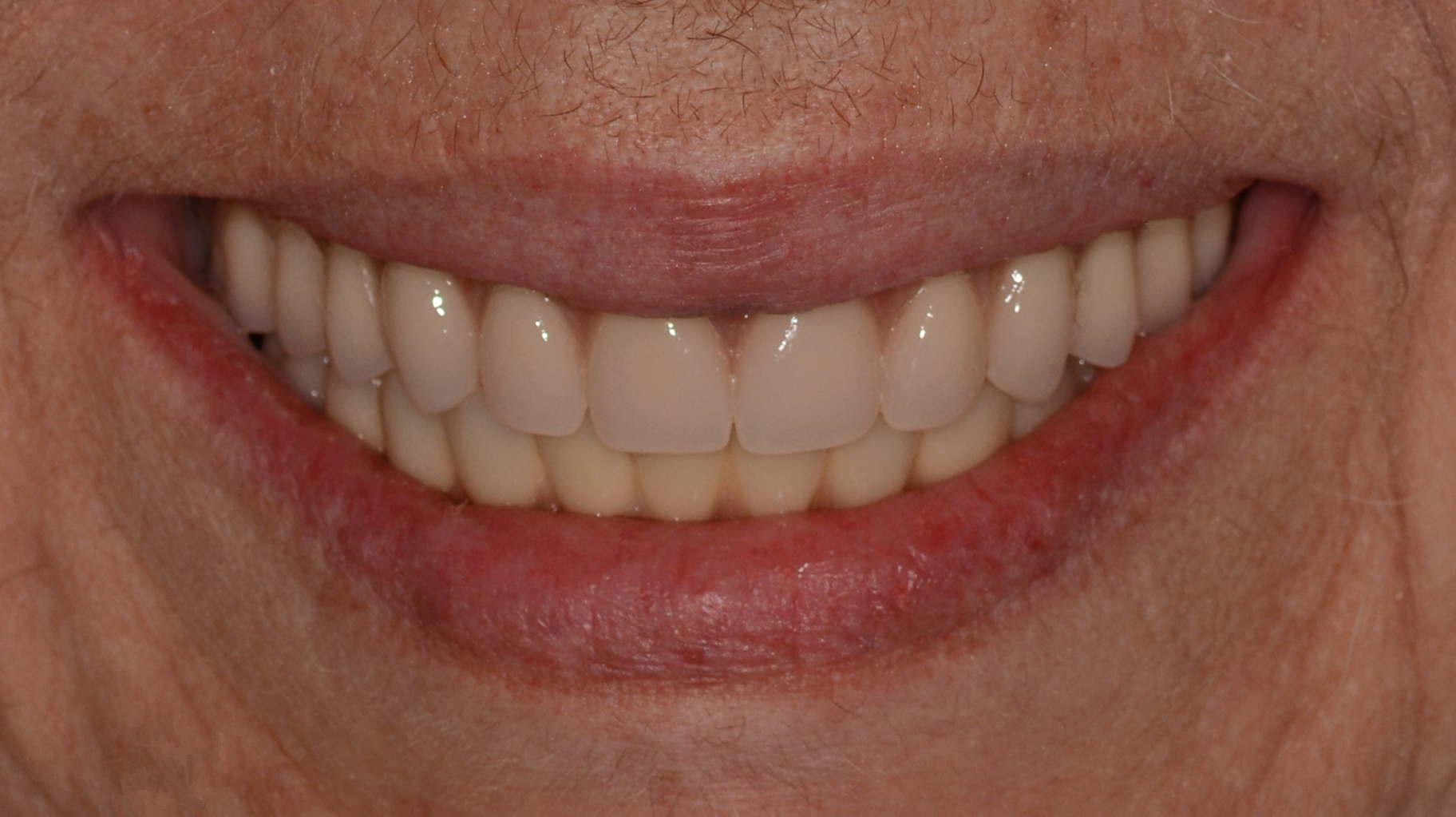 Elim Dental dentist in Mount Kisco, NY DR. JIN SUB OH, DMD, MS Schema yoast