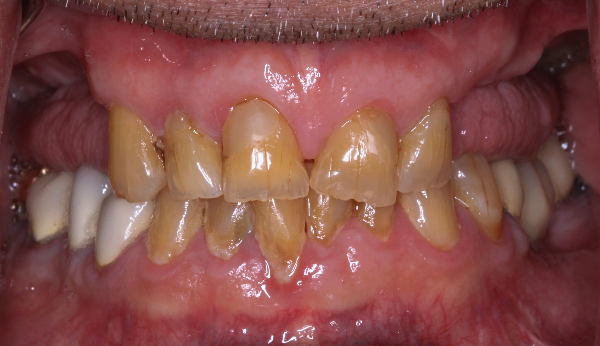Elim Dental dentist in Mount Kisco, NY DR. JIN SUB OH, DMD, MS Schema yoast