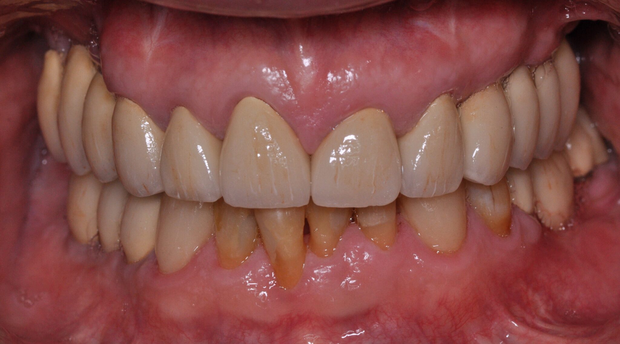 Elim Dental dentist in Mount Kisco, NY DR. JIN SUB OH, DMD, MS Schema yoast