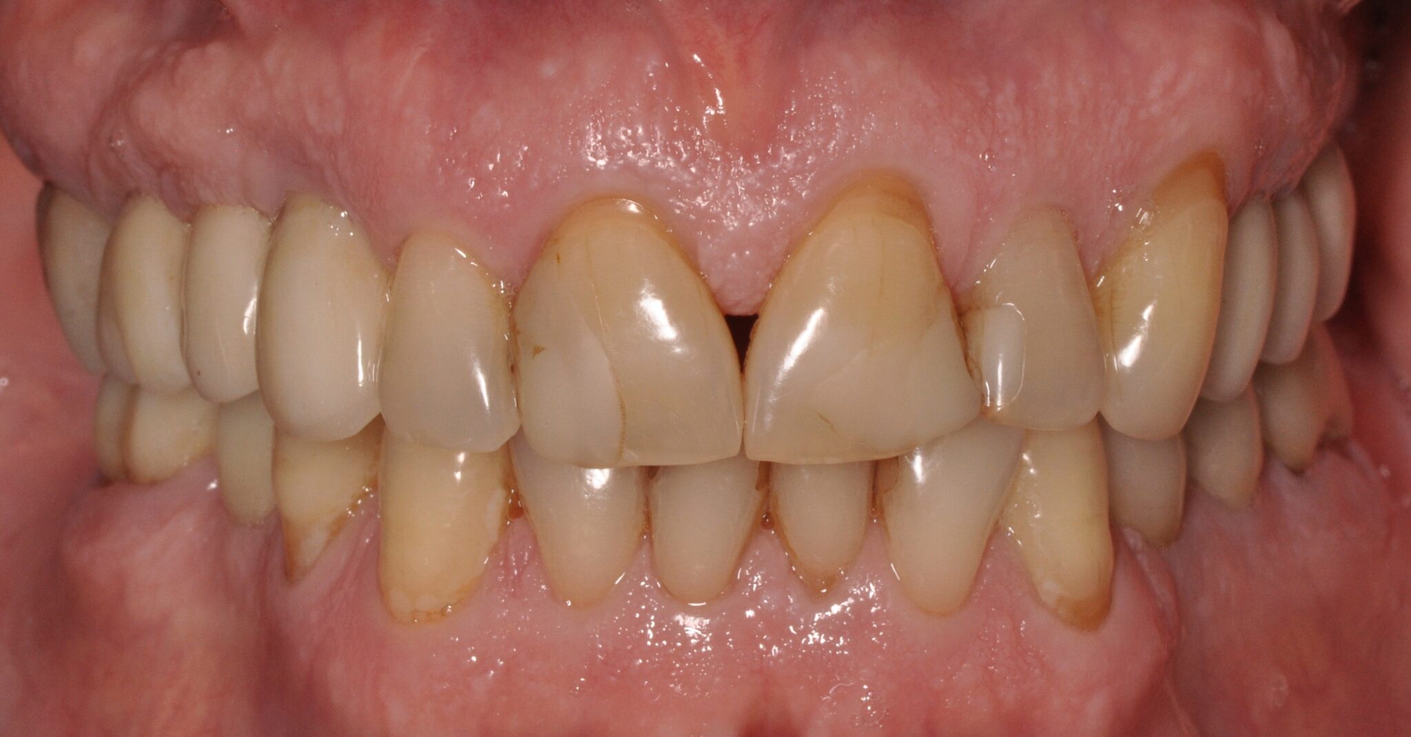 Elim Dental dentist in Mount Kisco, NY DR. JIN SUB OH, DMD, MS Schema yoast