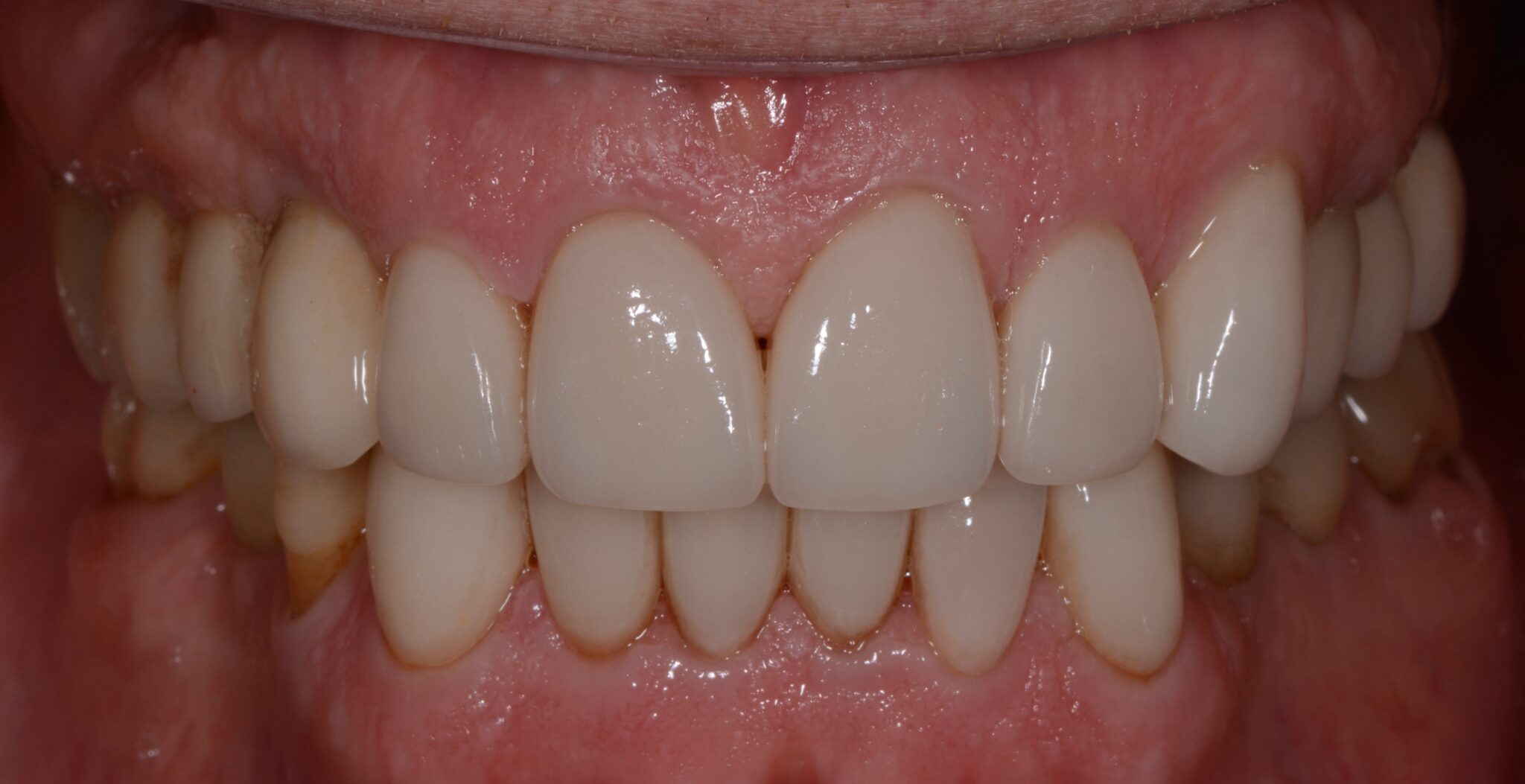 Elim Dental dentist in Mount Kisco, NY DR. JIN SUB OH, DMD, MS Schema yoast