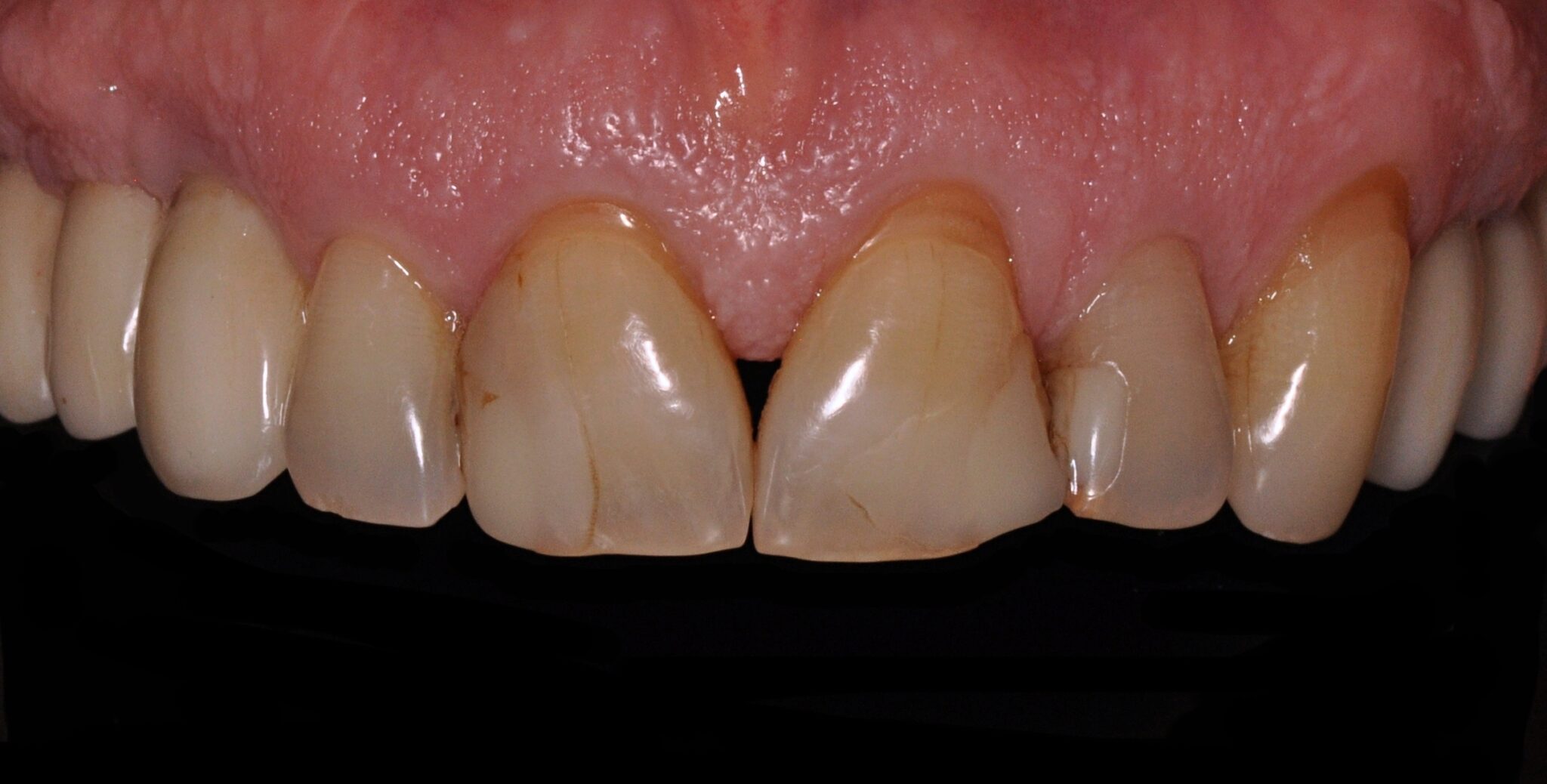 Elim Dental dentist in Mount Kisco, NY DR. JIN SUB OH, DMD, MS Schema yoast