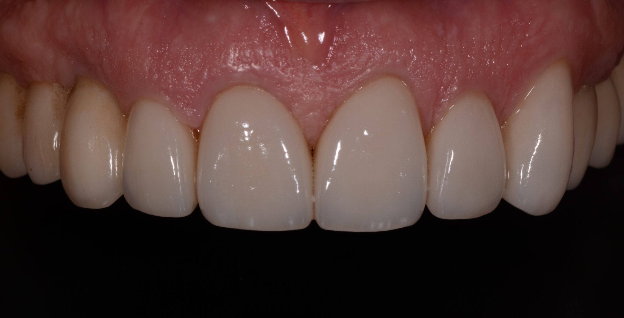 Elim Dental dentist in Mount Kisco, NY DR. JIN SUB OH, DMD, MS Schema yoast