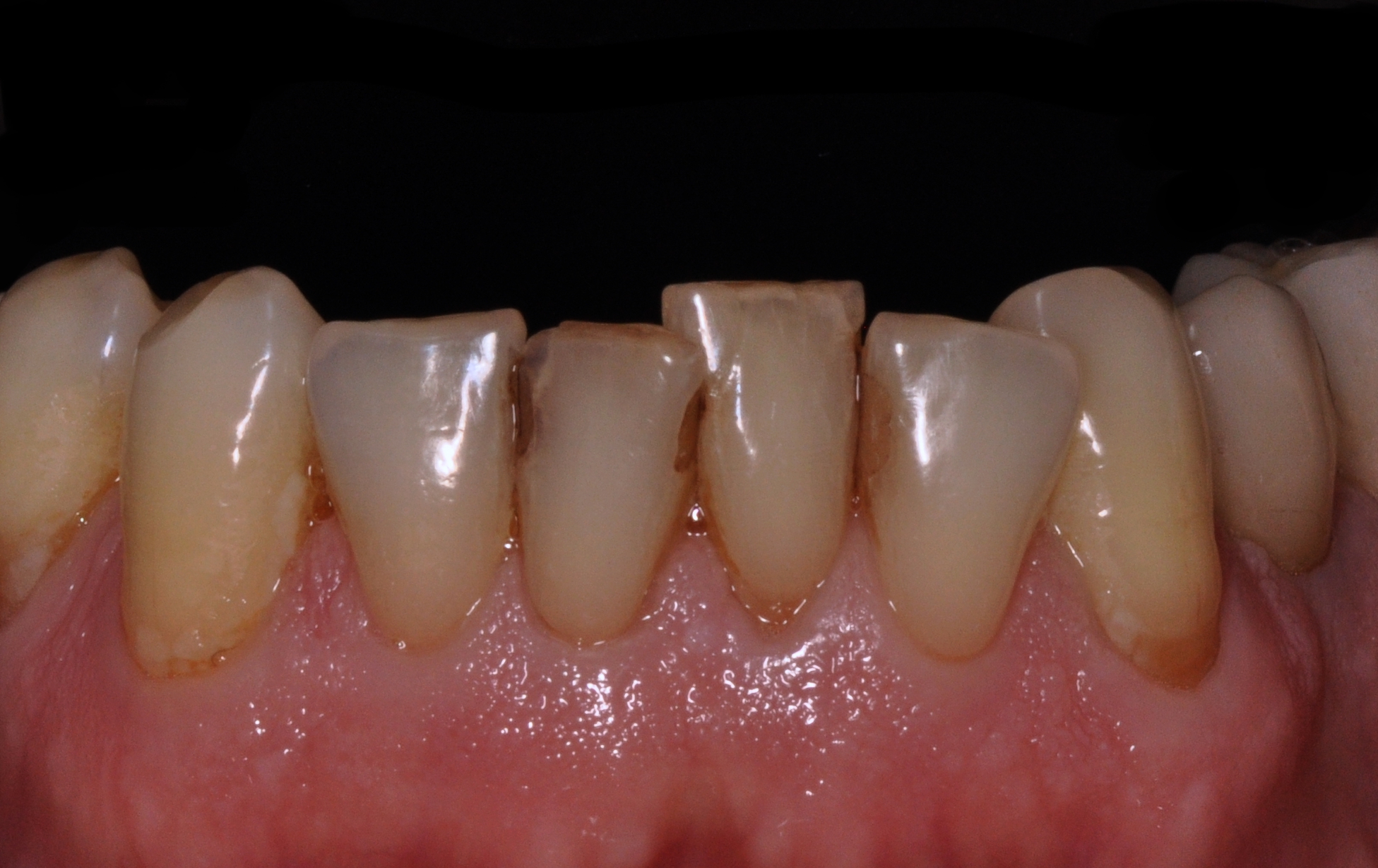Elim Dental dentist in Mount Kisco, NY DR. JIN SUB OH, DMD, MS Schema yoast