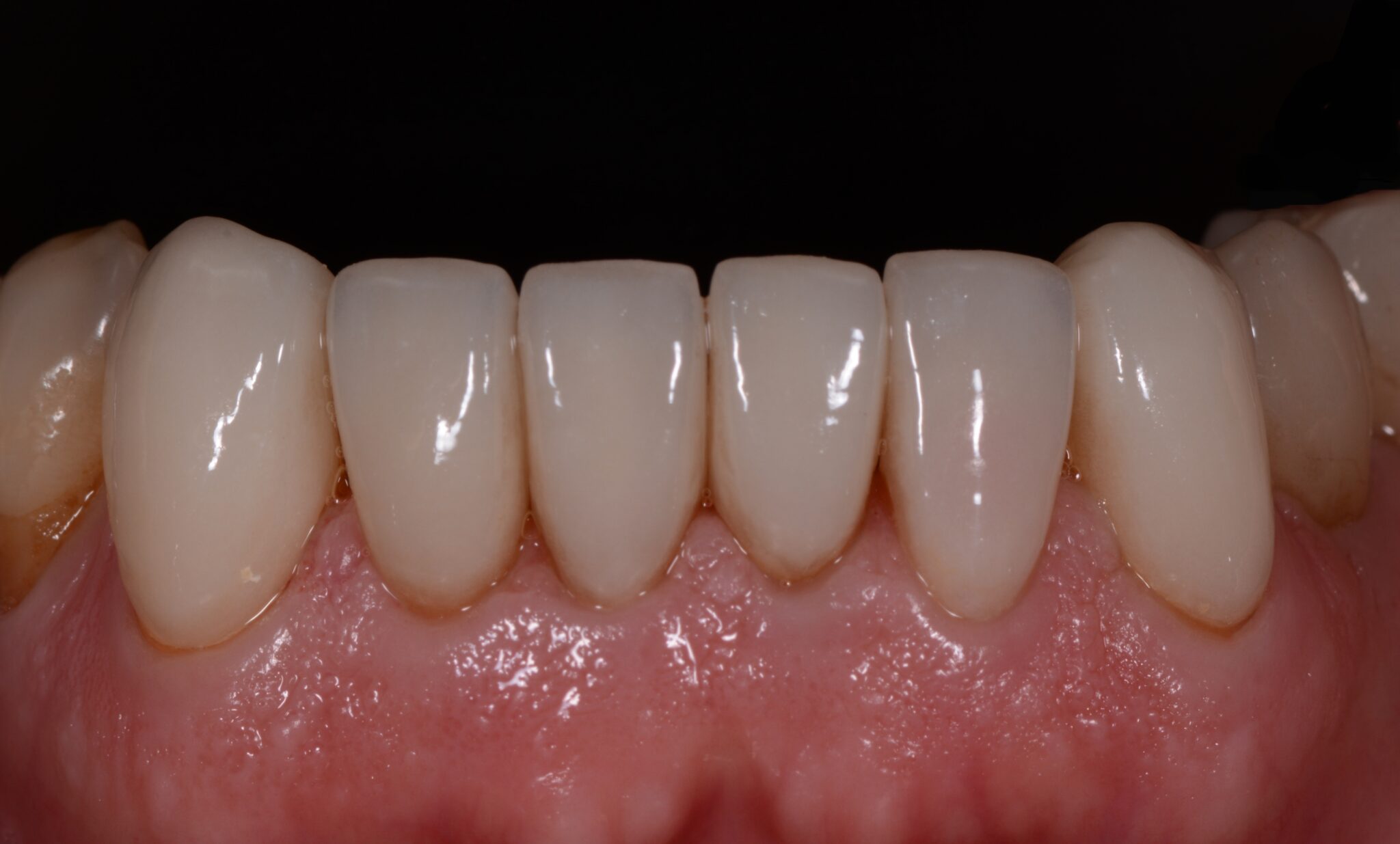 Elim Dental dentist in Mount Kisco, NY DR. JIN SUB OH, DMD, MS Schema yoast