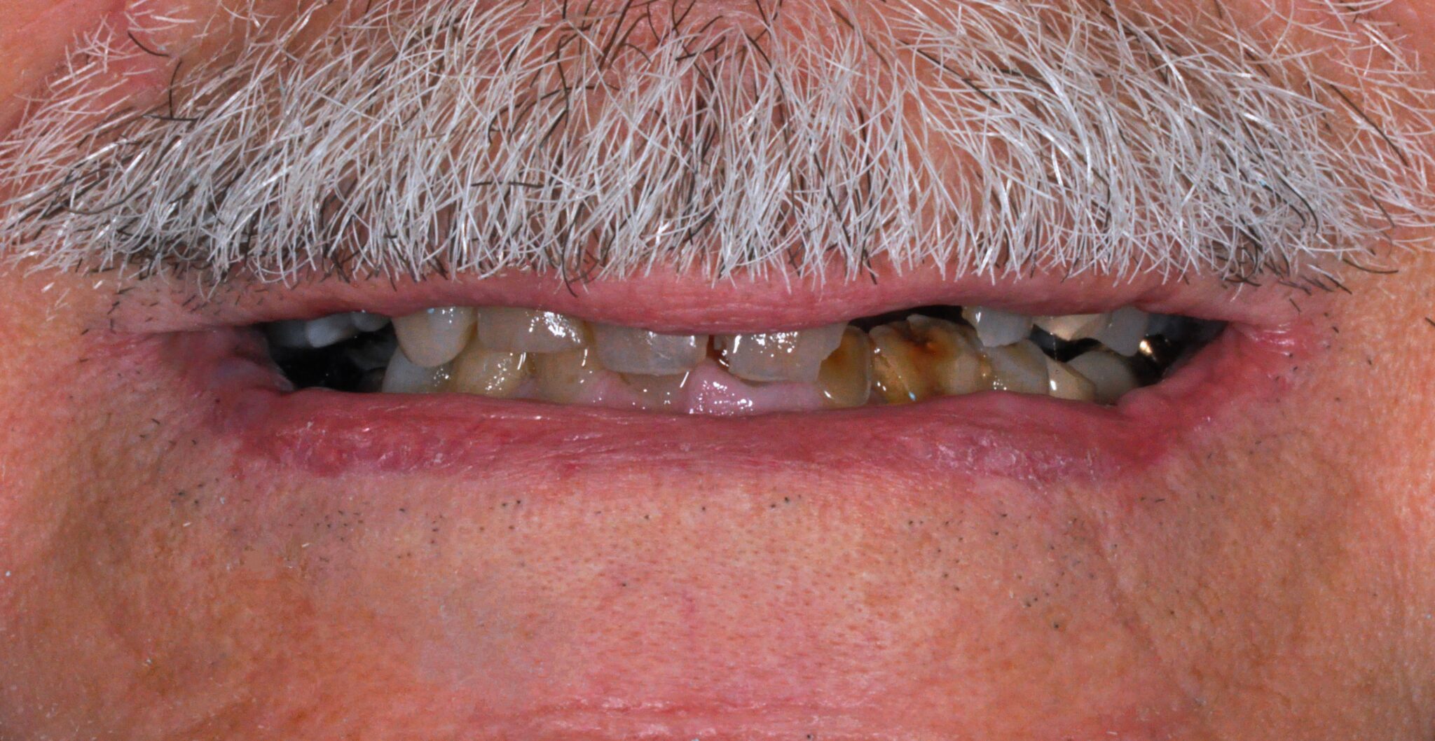 Elim Dental dentist in Mount Kisco, NY DR. JIN SUB OH, DMD, MS Schema yoast