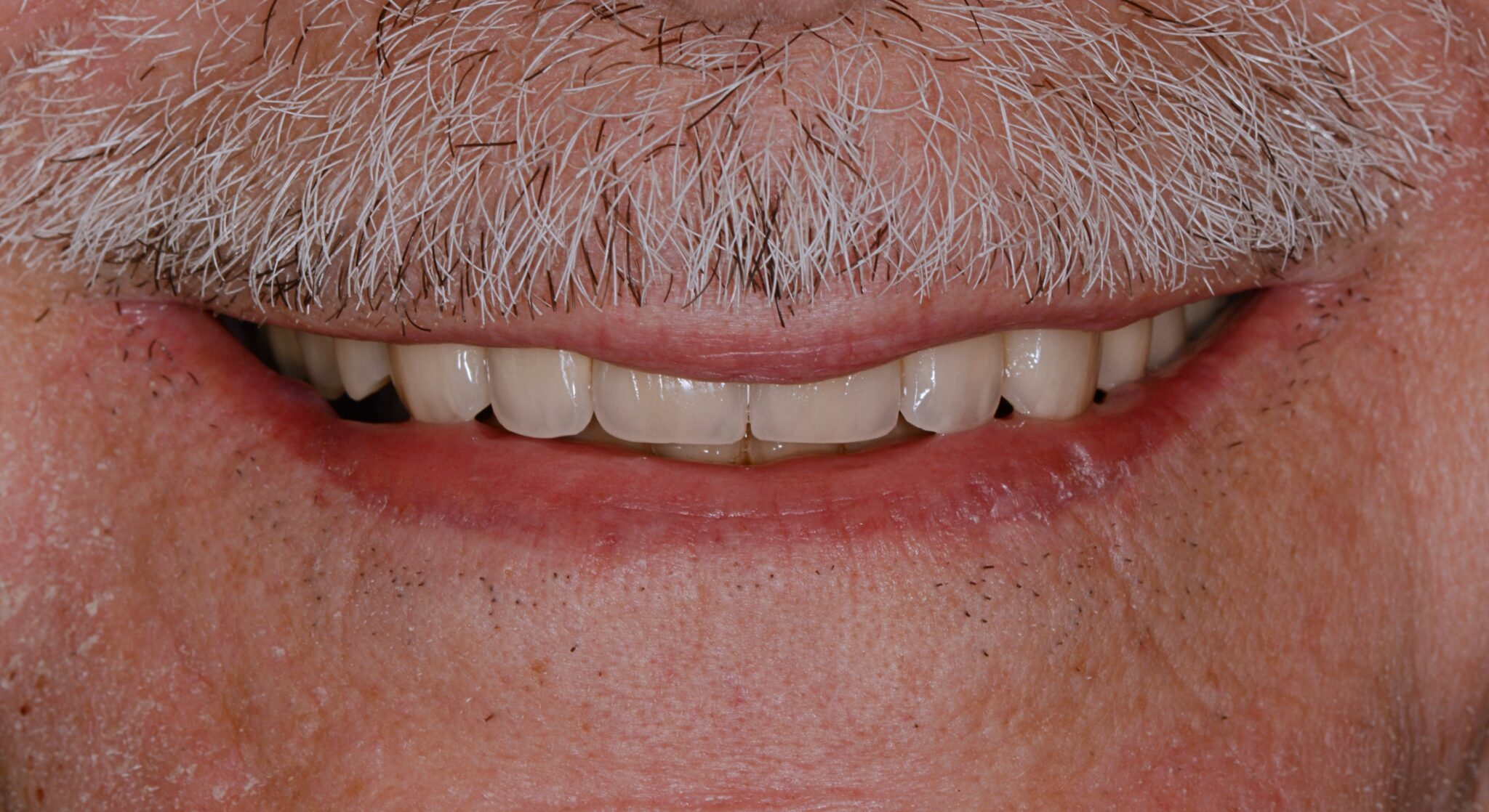 Elim Dental dentist in Mount Kisco, NY DR. JIN SUB OH, DMD, MS Schema yoast