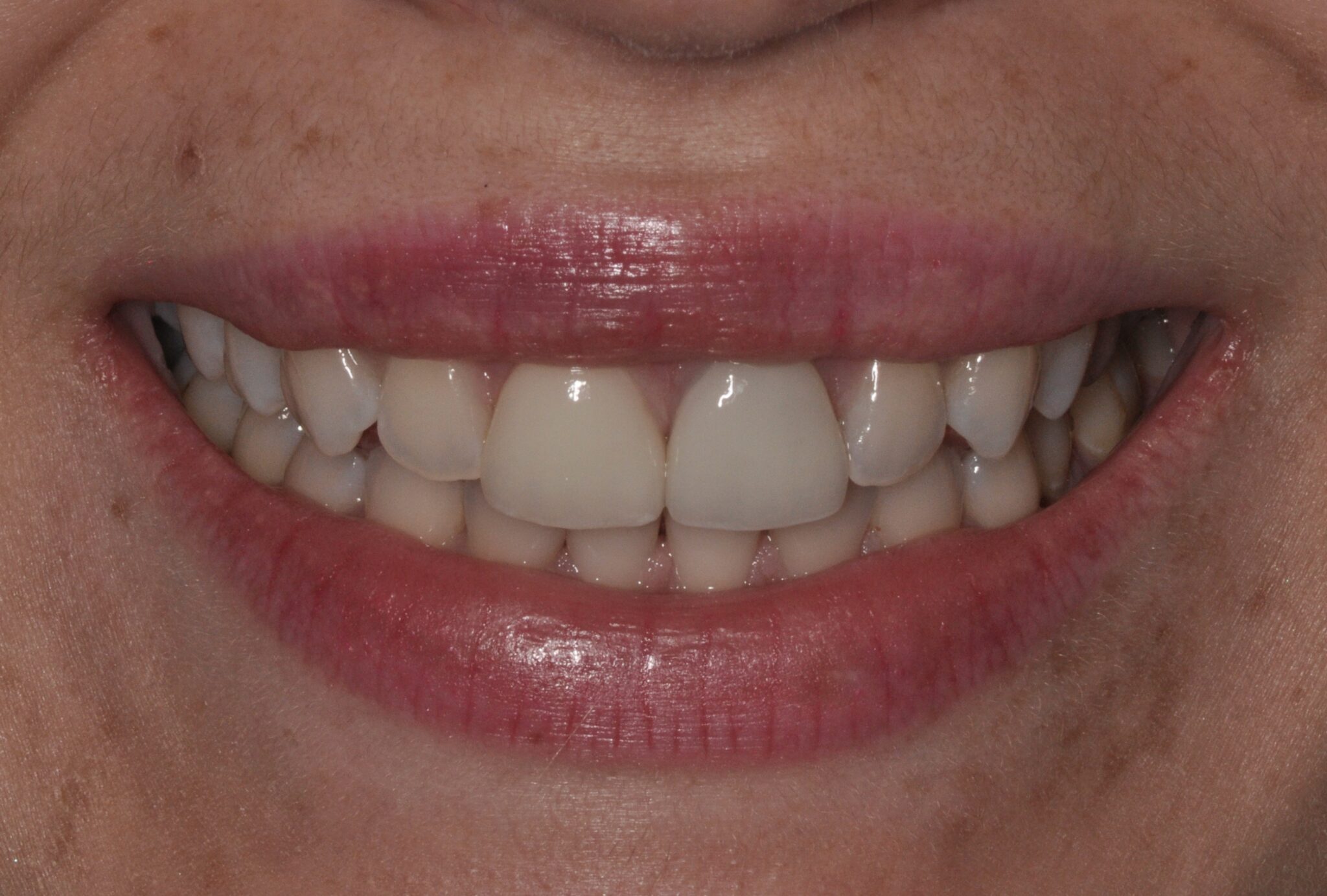 Elim Dental dentist in Mount Kisco, NY DR. JIN SUB OH, DMD, MS Schema yoast