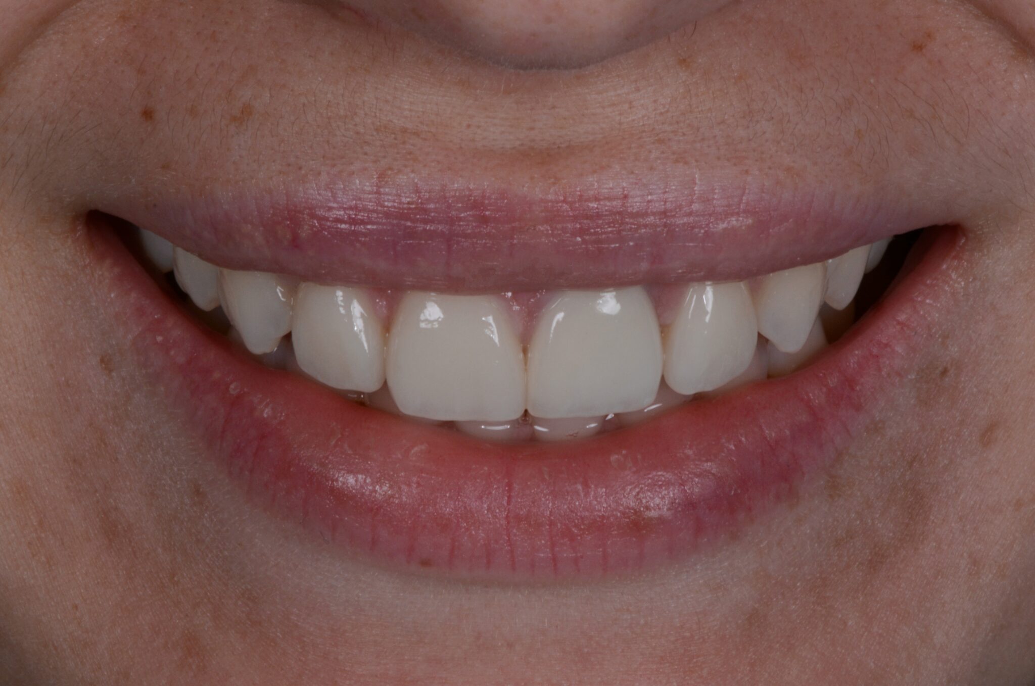 Elim Dental dentist in Mount Kisco, NY DR. JIN SUB OH, DMD, MS Schema yoast