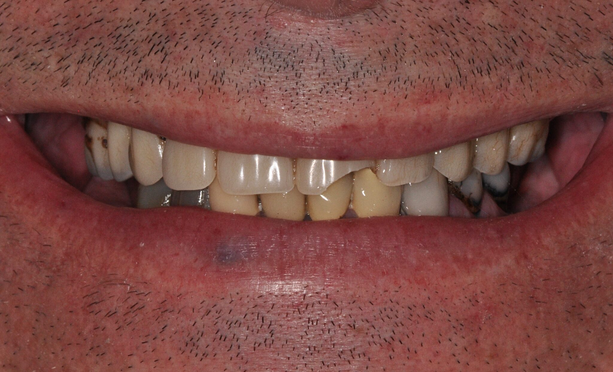 Elim Dental dentist in Mount Kisco, NY DR. JIN SUB OH, DMD, MS Schema yoast