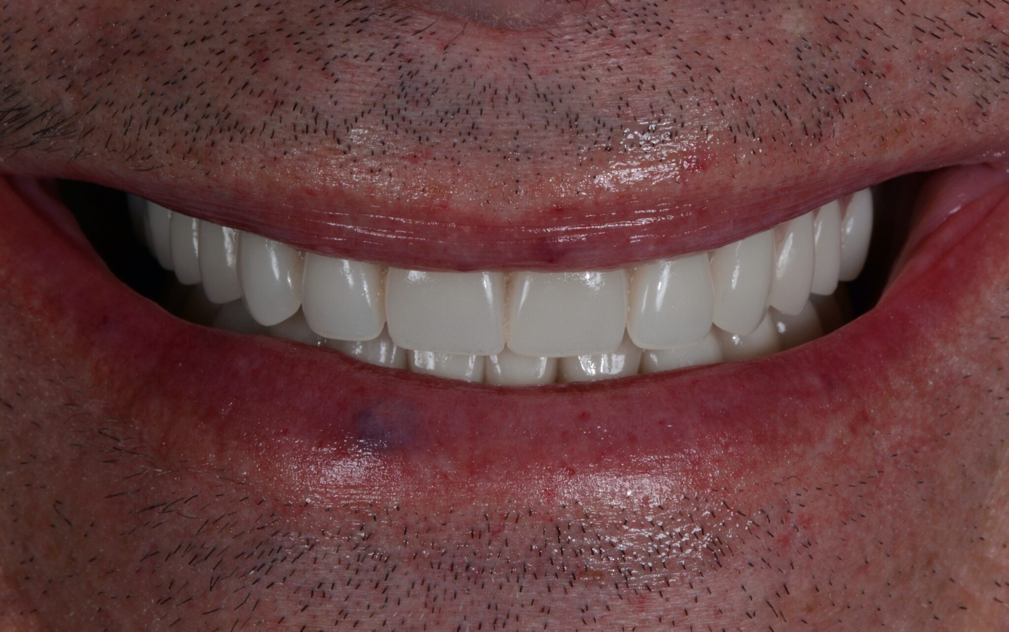 Elim Dental dentist in Mount Kisco, NY DR. JIN SUB OH, DMD, MS Schema yoast