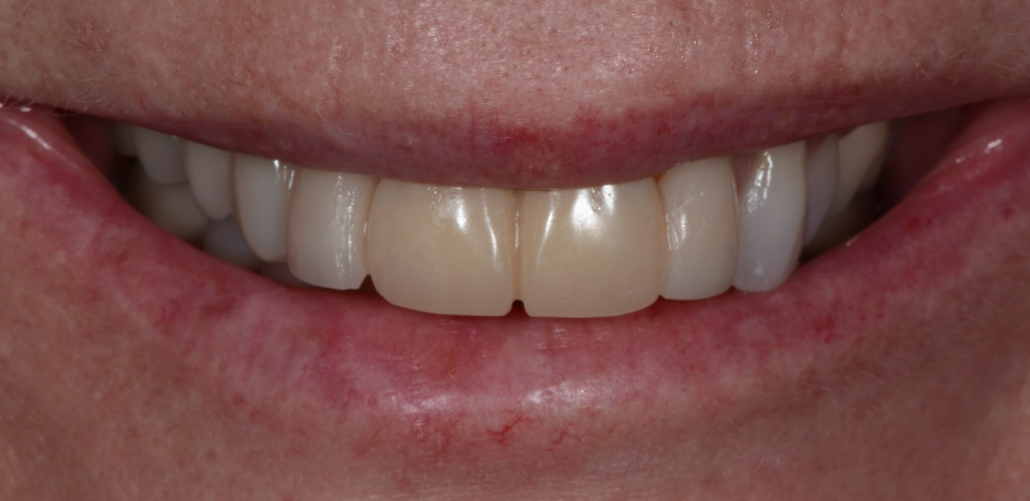 Elim Dental dentist in Mount Kisco, NY DR. JIN SUB OH, DMD, MS Schema yoast