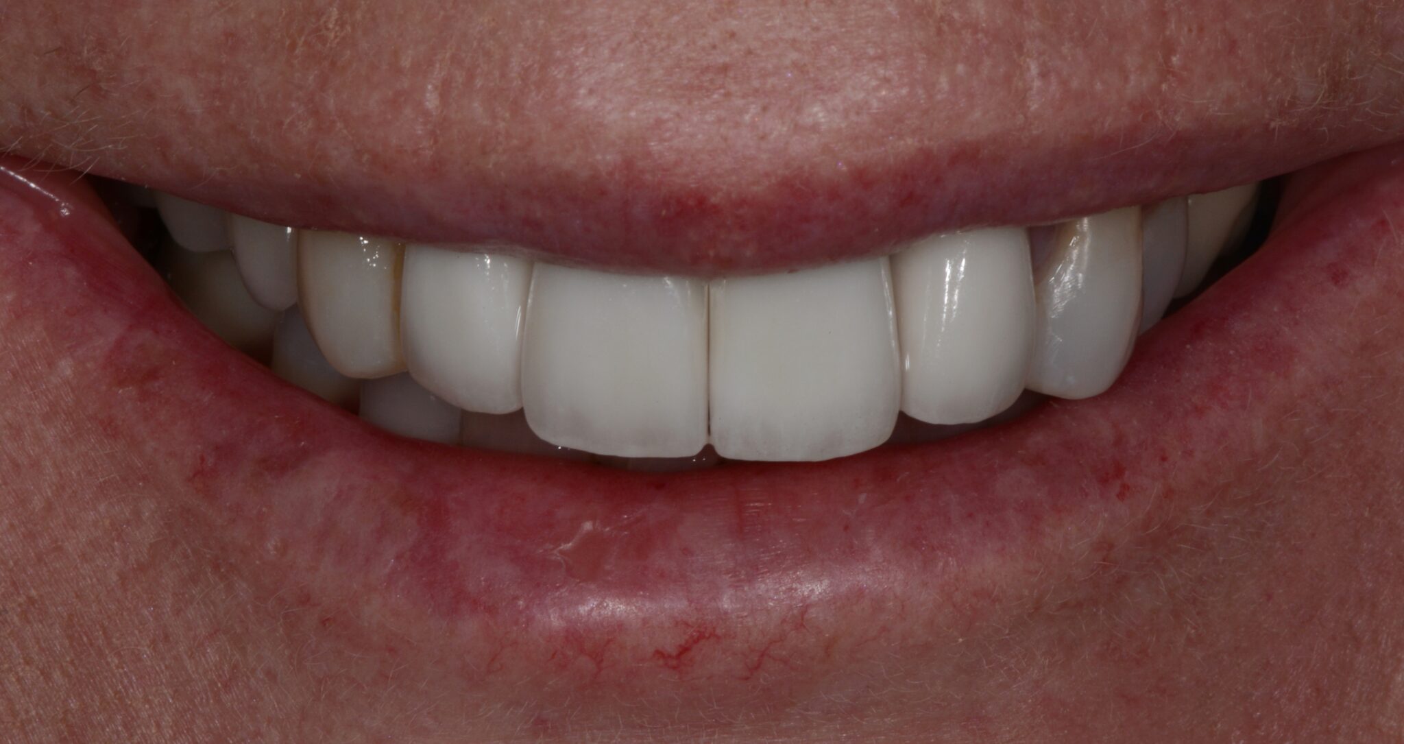 Elim Dental dentist in Mount Kisco, NY DR. JIN SUB OH, DMD, MS Schema yoast