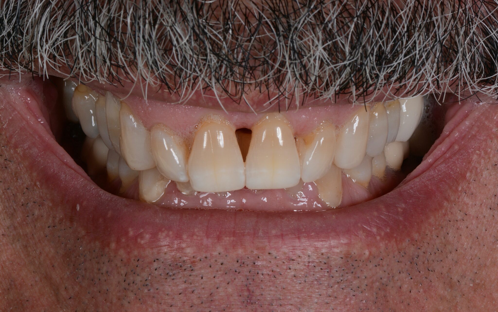 Elim Dental dentist in Mount Kisco, NY DR. JIN SUB OH, DMD, MS Schema yoast