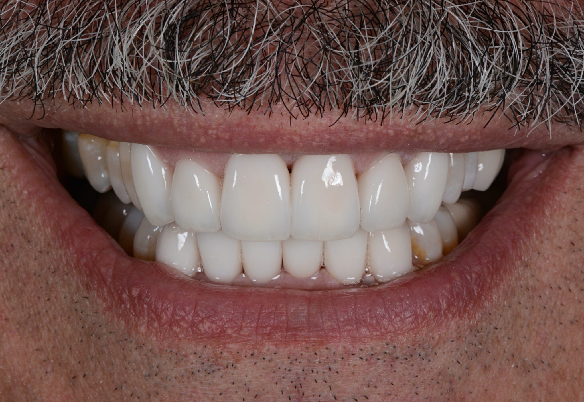 Elim Dental dentist in Mount Kisco, NY DR. JIN SUB OH, DMD, MS Schema yoast