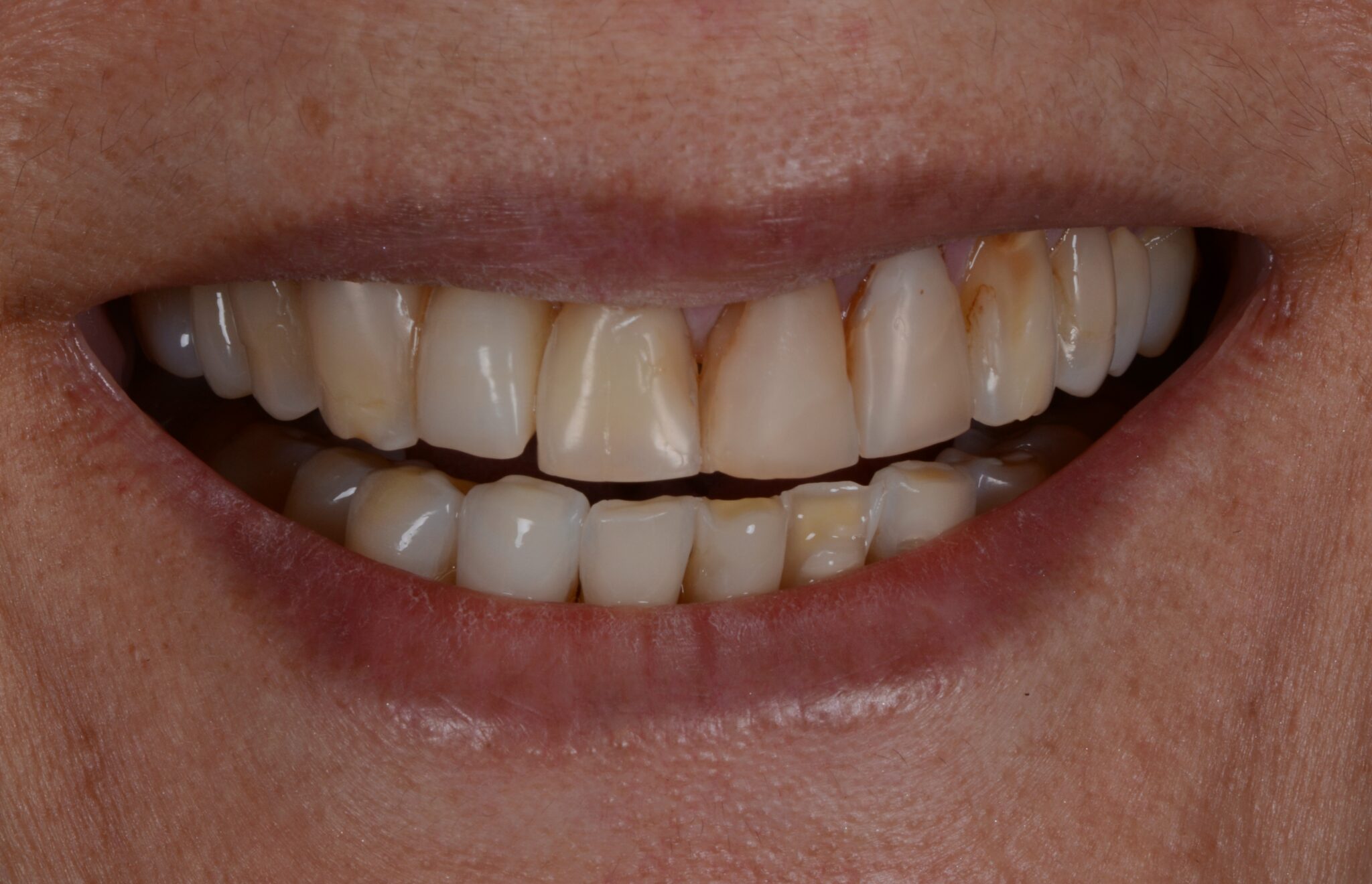 Elim Dental dentist in Mount Kisco, NY DR. JIN SUB OH, DMD, MS Schema yoast