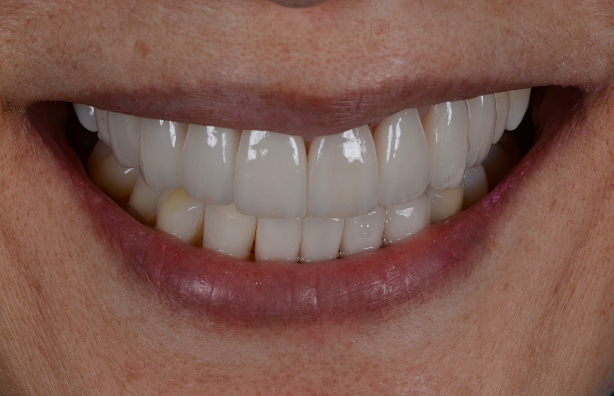 Elim Dental dentist in Mount Kisco, NY DR. JIN SUB OH, DMD, MS Schema yoast