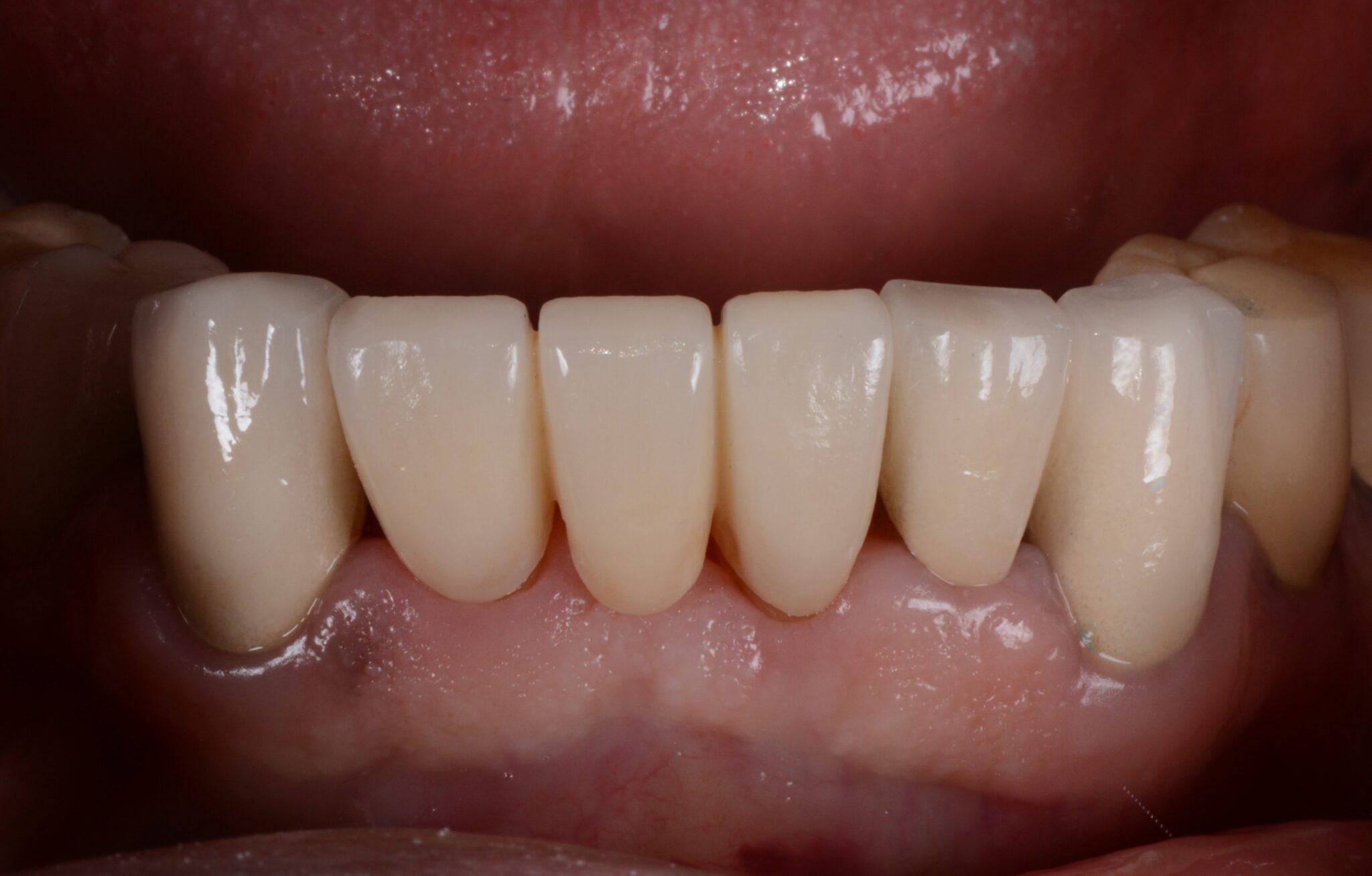 Elim Dental dentist in Mount Kisco, NY DR. JIN SUB OH, DMD, MS Schema yoast